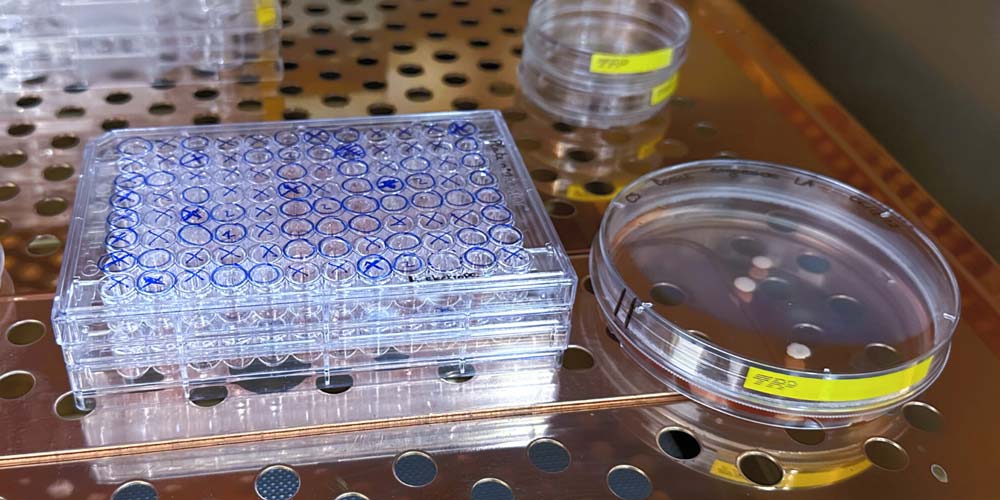 Organoid-modeling-