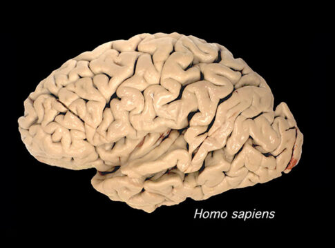 brains_chimp_human