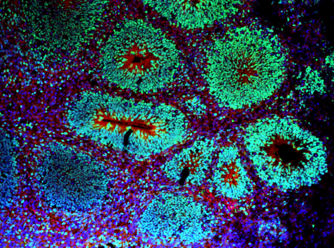 D60_ZB2_CAU_P22_FOXG1647_PAX6488_DAPI.nd2 (RGB)