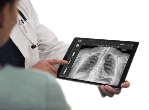 Doctor-showing-x-ray-image-on-tablet- copy